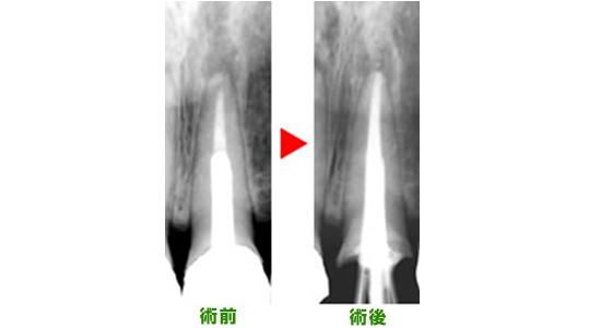 治療前と治療後